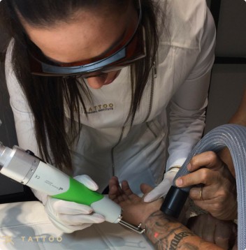 Tattoo Removing on the upper part of a mans arm with woman